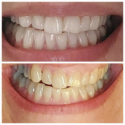 Magic Whitening Toothpaste Booster®
